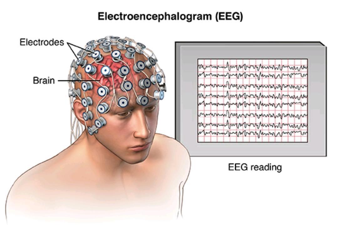 Epilepsy |EEG |Karuwakispeaks