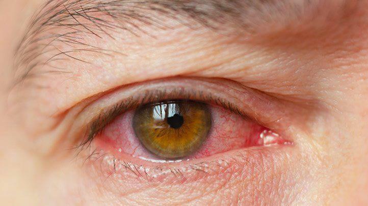 Eye care tips to protect the gift of sight |Dr.Sabyasachi Patnaik |Karuwakispeaks